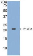 Polyclonal Antibody to Tumor Necrosis Factor Alpha (TNFa)