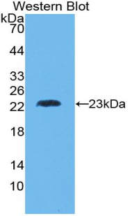 Polyclonal Antibody to Tumor Necrosis Factor Beta (TNFb)