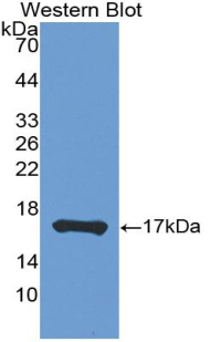 Polyclonal Antibody to Tumor Necrosis Factor Beta (TNFb)