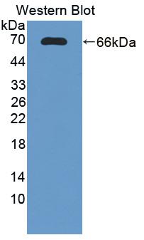 Polyclonal Antibody to Tumor Necrosis Factor Receptor Superfamily, Member 10C (TNFRSF10C)