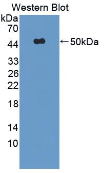 Polyclonal Antibody to Tumor Necrosis Factor Related Apoptosis Inducing Ligand (TRAIL)