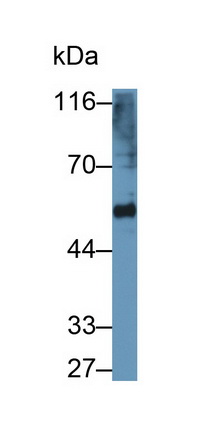 Polyclonal Antibody to Plasminogen Activator, Urokinase (uPA)