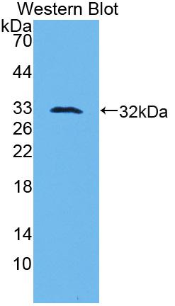 Polyclonal Antibody to Plasminogen Activator, Urokinase (uPA)