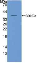 Polyclonal Antibody to Plasminogen Activator, Urokinase Receptor (uPAR)