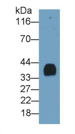 Polyclonal Antibody to Plasminogen Activator, Urokinase Receptor (uPAR)