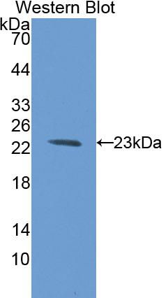 Polyclonal Antibody to Plasminogen Activator, Urokinase Receptor (uPAR)