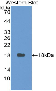 Polyclonal Antibody to Vascular Endothelial Growth Factor A (VEGFA)