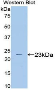 Polyclonal Antibody to Vascular Endothelial Growth Factor A (VEGFA)