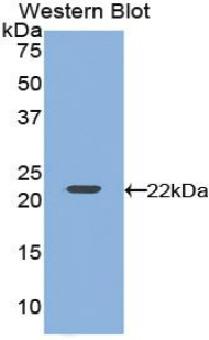 FITC-Linked Polyclonal Antibody to Vascular Endothelial Growth Factor A (VEGFA)