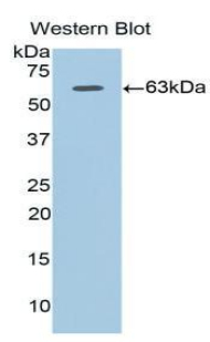 Polyclonal Antibody to Adiponectin Receptor 1 (ADIPOR1)