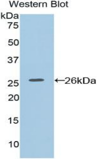 Polyclonal Antibody to Coagulation Factor VIII Associated Protein 1 (F8A1)