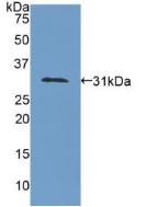 Polyclonal Antibody to Collagen Type IV Alpha 1 (COL4a1)
