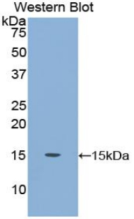 Polyclonal Antibody to Carcinoembryonic Antigen (CEA)