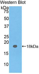 Biotin-Linked Polyclonal Antibody to Carcinoembryonic Antigen (CEA)