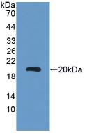 Polyclonal Antibody to Carcinoembryonic Antigen (CEA)