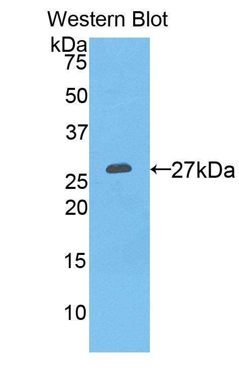 Polyclonal Antibody to Prostate Specific Antigen (PSA)