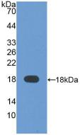 Polyclonal Antibody to Alpha-Fetoprotein (AFP)