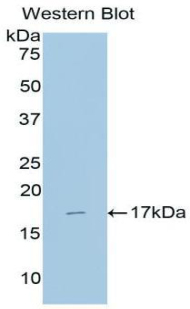 FITC-Linked Polyclonal Antibody to Alpha-Fetoprotein (AFP)