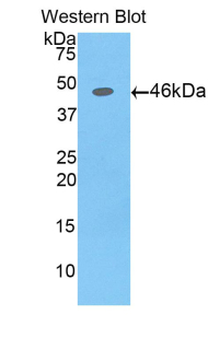 Polyclonal Antibody to Alpha-Fetoprotein (AFP)