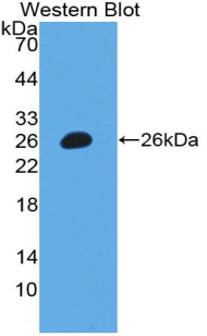 PAA154Hu71.jpg