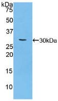 Polyclonal Antibody to Carbohydrate Antigen 125 (C<b>A125</b>)