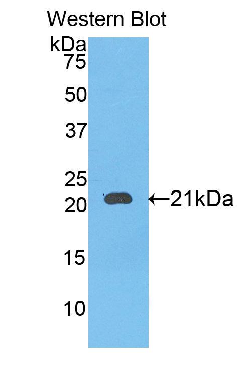 Polyclonal Antibody to Serpin Peptidase Inhibitor,Clade B,Member 4 (SERPINB4)