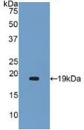 Polyclonal Antibody to Alpha 2-Antiplasmin (a2PI)