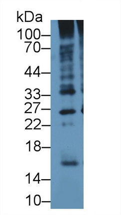 PAA164Hu01.jpg