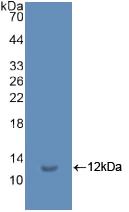 Polyclonal Antibody to Ubiquitin (Ub)