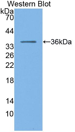 Polyclonal Antibody to Pepsinogen C (PGC)