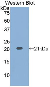 Polyclonal Antibody to Prostatic Acid Phosphatase (PAP)