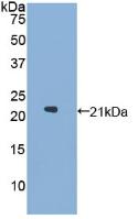 Polyclonal Antibody to Glucosidase Alpha, Acid (GaA)