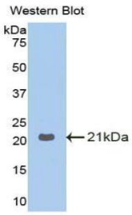 Polyclonal Antibody to Glucosidase Alpha, Acid (GaA)