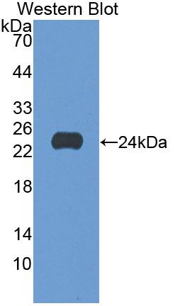 Polyclonal Antibody to Glucosidase Alpha, Acid (GaA)