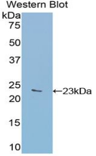 Polyclonal Antibody to Glucosidase Alpha, Acid (GaA)