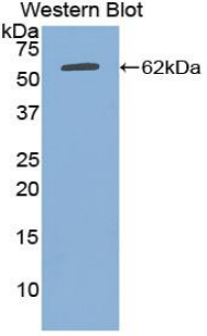 Polyclonal Antibody to Alpha-2-Heremans Schmid Glycoprotein (AHSG)