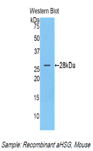 Polyclonal Antibody to Alpha-2-Heremans Schmid Glycoprotein (AHSG)