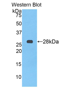 Polyclonal Antibody to Alpha-2-Heremans Schmid Glycoprotein (AHSG)