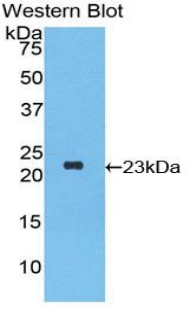 PAA179Hu01.jpg