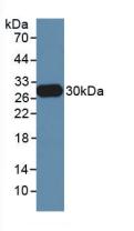 Polyclonal Antibody to Neutrophil Elastase (NE)