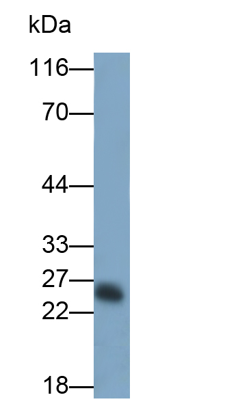 Polyclonal Antibody to Neutrophil Elastase (NE)