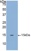 Polyclonal Antibody to Galactosidase Alpha (GLa)