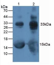 Polyclonal Antibody to Glycated Hemoglobin A1c (HbA1c)