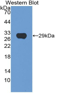 Polyclonal Antibody to Hexosaminidase A Alpha (HEXa)