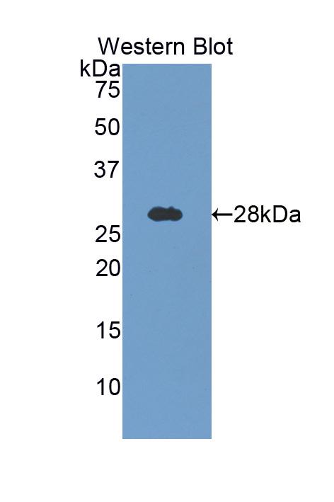 Polyclonal Antibody to Galactosidase Beta (GLb)