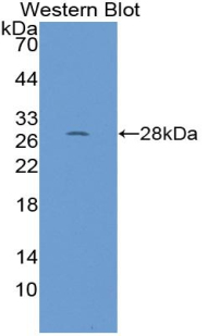 Polyclonal Antibody to Ribonuclease P (RNASEP)