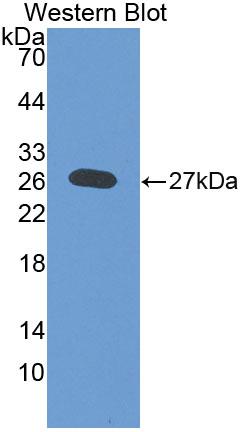 Polyclonal Antibody to Deoxyribonuclease I Like Protein 2 (DNASE1L2)