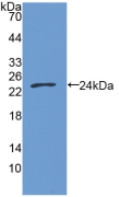 Polyclonal Antibody to Growth Arrest Specific Protein 6 (GAS6)