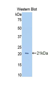 Polyclonal Antibody to Growth Arrest Specific Protein 6 (GAS6)