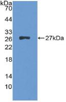 Polyclonal Antibody to Alanine Aminotransferase (ALT)